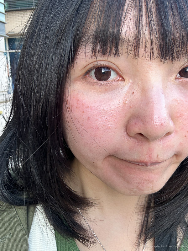 杰美學診所，台南蜂巢皮秒雷射